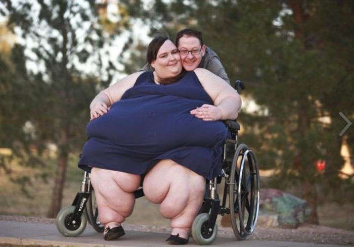 Люди, які страждають від ожиріння (17 фото)