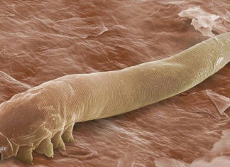 Крихітні кліщі живуть всередині вашого обличчя і ви нічого не можете з цим вдіяти