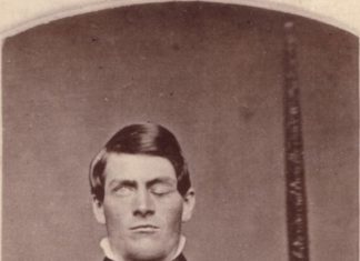 Лоботомія. Історія патрання мізків, або Сама ганебна Нобелівська премія