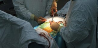 Учені розповіли про небезпеку видалення апендикса