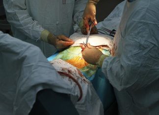 Учені розповіли про небезпеку видалення апендикса