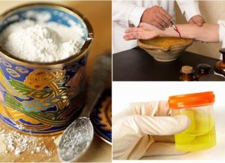 Чудеса від лікарів: 10 незвичайних способів лікування в медицині