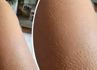 15 чоловіків і жінок, які полюбили своє унікальне тіло, замість того щоб його соромитися