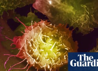 Британська комісія охорони здоров’я відкидає масове обстеження на рак простати, незважаючи на суперечки