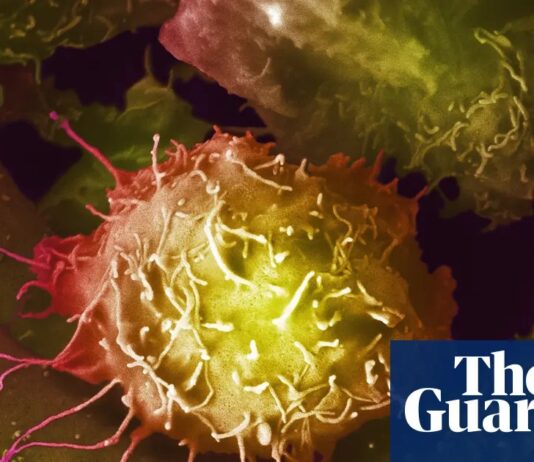 Британська комісія охорони здоров’я відкидає масове обстеження на рак простати, незважаючи на суперечки