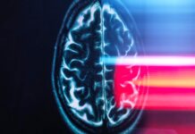 Мозок Астронавтів Зсувається Під час Космічних Польотів: Нове Дослідження Розкриває Фізичні Зміни