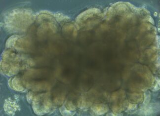 Вирощена в Лабораторії Тканина Мозку Навчається Вирішувати Інженерні Завдання